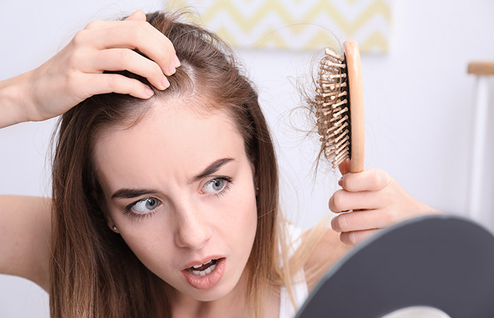 What are the causes of female hair loss